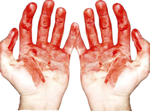 Blood on his hands